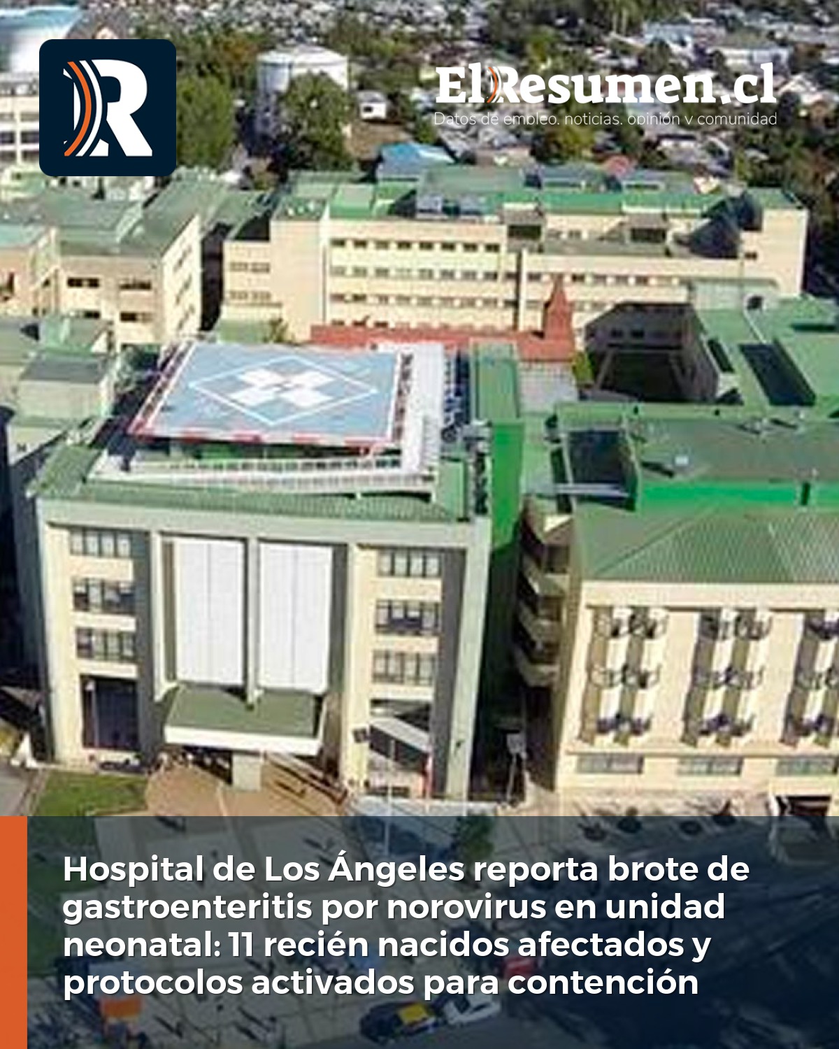 Hospital de Los Ángeles reporta brote de gastroenteritis por norovirus en unidad neonatal: 11 recién nacidos afectados y protocolos activados para contención