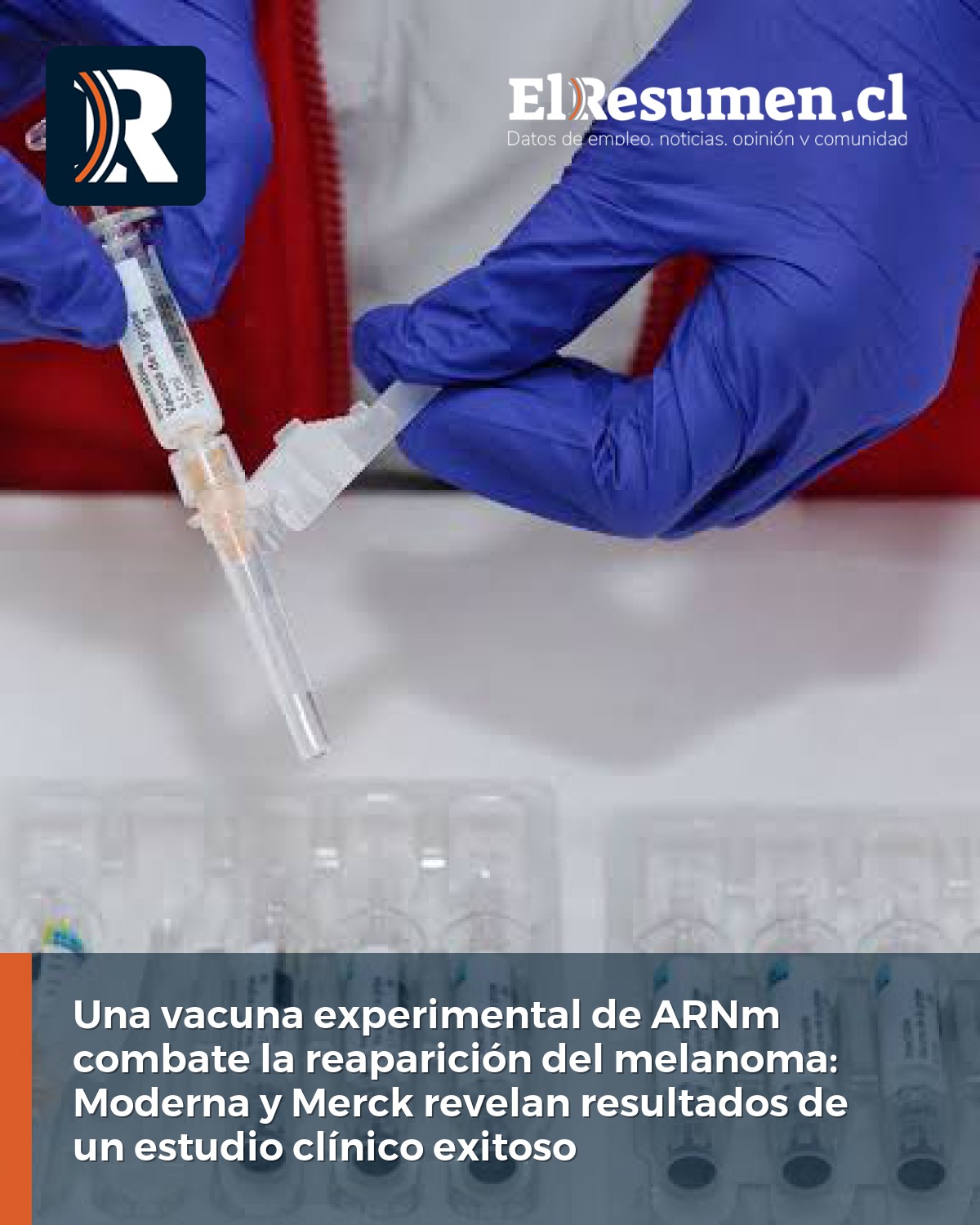 Una vacuna experimental de ARNm combate la reaparición del melanoma: Moderna y Merck revelan resultados de un estudio clínico exitoso