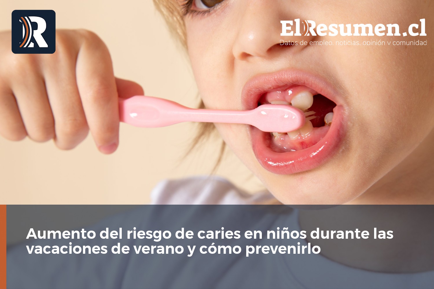 Aumento del riesgo de caries en niños durante las vacaciones de verano y cómo prevenirlo