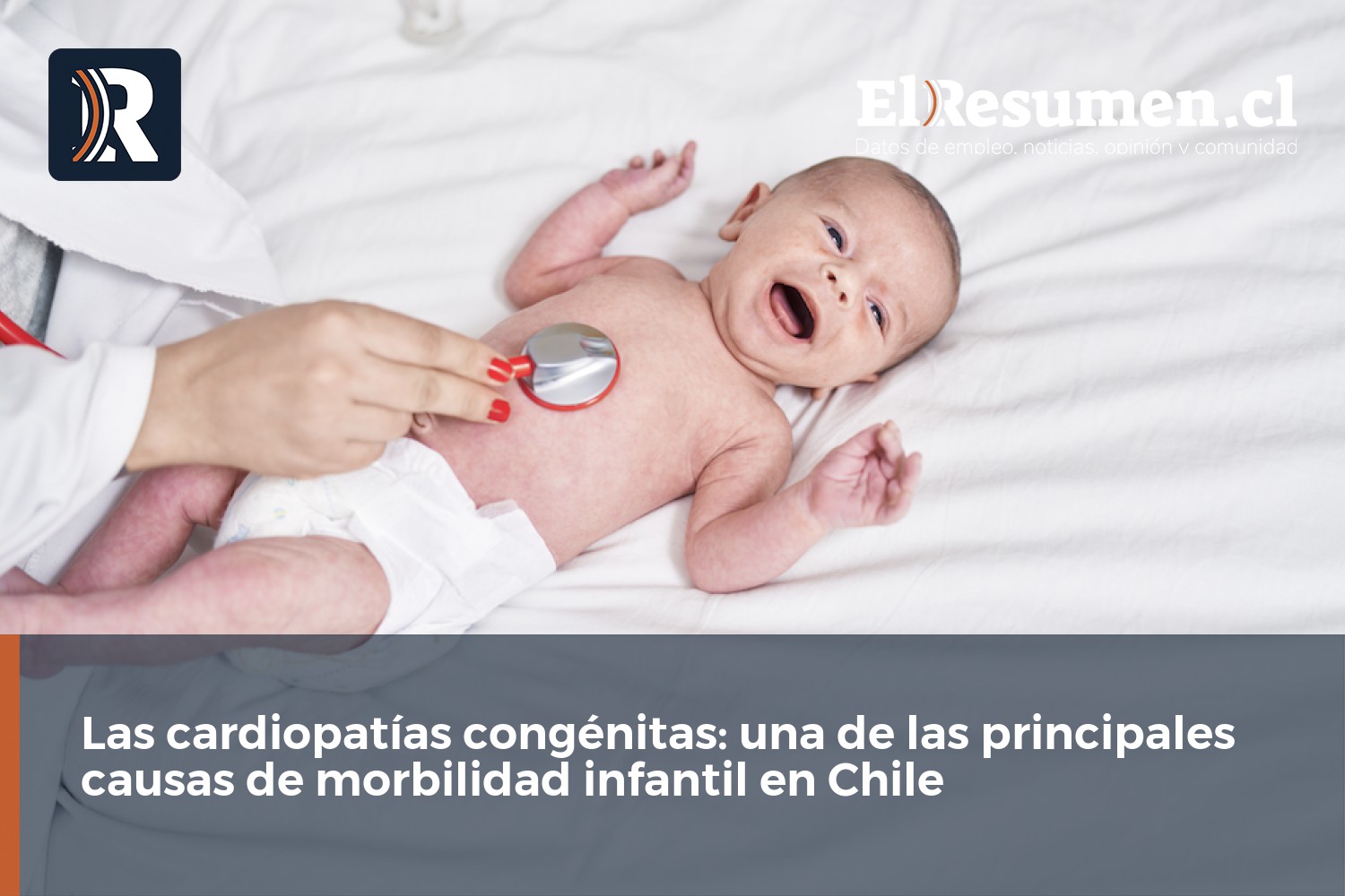 Las cardiopatías congénitas: una de las principales causas de morbilidad infantil en Chile