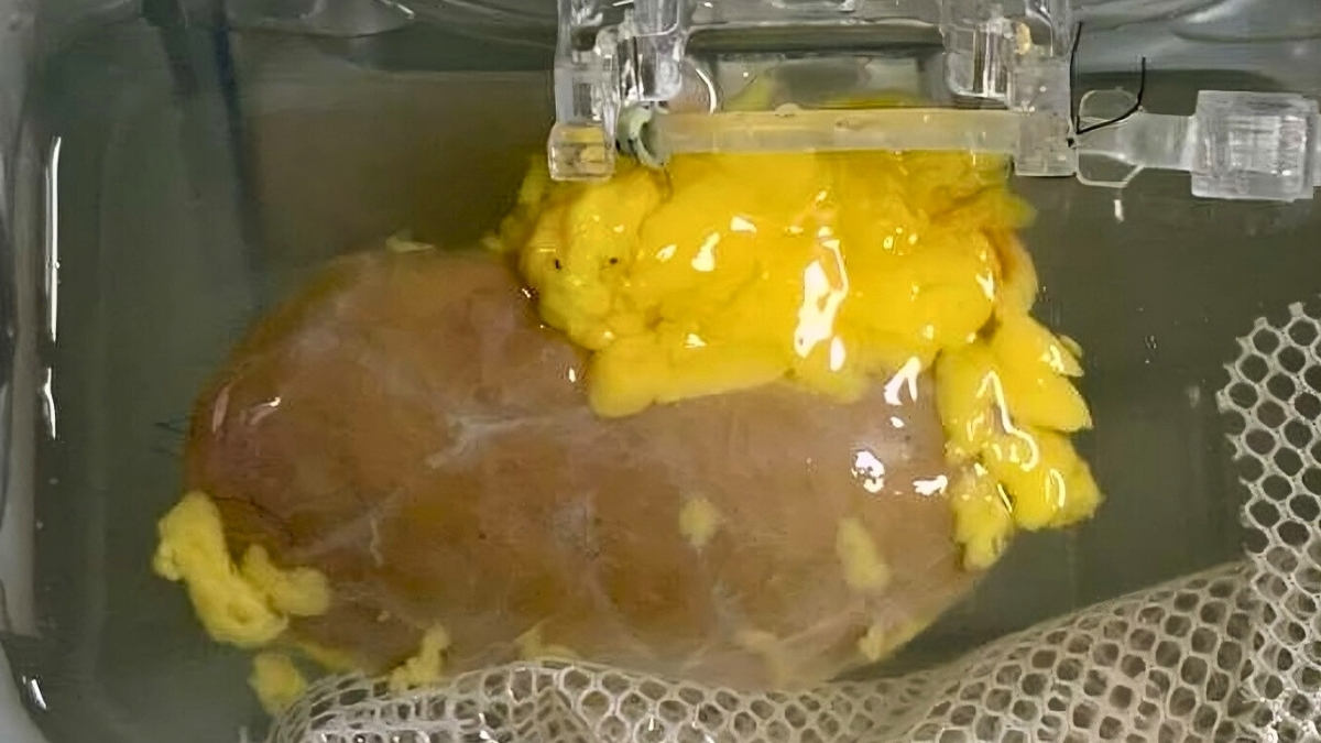 Investigadores logran desarrollar el primer riñón universal del mundo, un avance que podría cambiar la donación de órganos